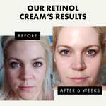 ORGANIC Retinol Cream for Face Anti Wrinkle Moisturizer £2.99 Sold by Eclat Skincare - 1 Dermatologist Developed and Fulfilled by Amazon