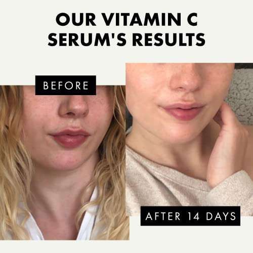 Eclat Vitamin C Serum Hyraluronic Acid & Retinol (Prime Only/£1.69 S&S?) Sold by Eclat Skincare / Fulfilled By Amazon