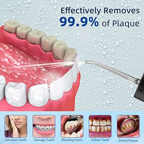 Water Flosser for Teeth Cordless, GEEDIAR Oral Irrigator Portable 190ML w/voucher - Sold by FANTASY MANOR E-COMMERCE CO., LTD FBA