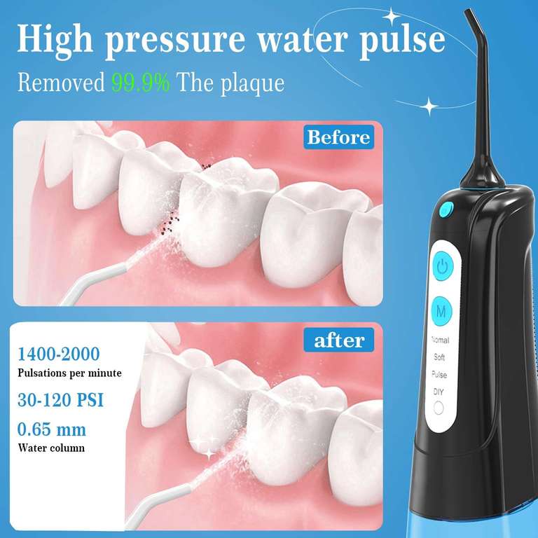 SURFOU Water Flosser for Teeth, Cordless Oral Irrigator 4 Modes 5 Jet Tips with 300ML IPX7 Waterproof USB w/voucher